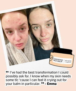 UpCircle Double Cleansing Bundle
