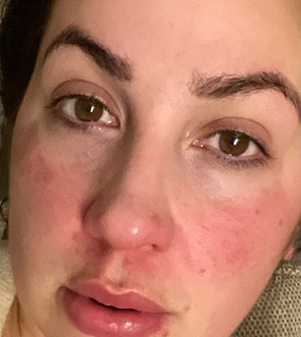 UpCircle Face Peptide Serum to Boost Collagen + Hydration