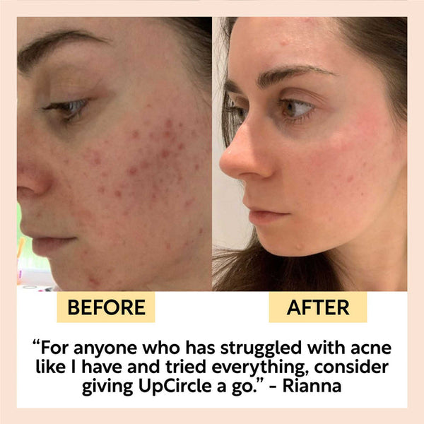 UpCircle Face Toner with Hyaluronic Acid