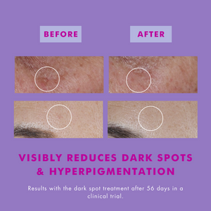 Hello Sunday the Glow Dark Spot Serum SPF40 with Hexylresorcinol - 30ml