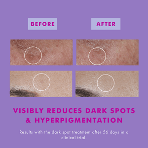 Hello Sunday the Glow Dark Spot Serum SPF40 with Hexylresorcinol - 30ml - Plastic Freedom