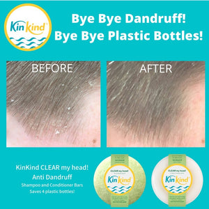 KinKind Anti Dandruff Shampoo Bar 50g - for Flaky Scalp - Plastic Freedom