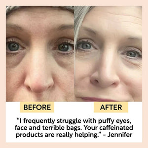 UpCircle Eye Cream with Hyaluronic Acid + Coffee - Plastic Freedom