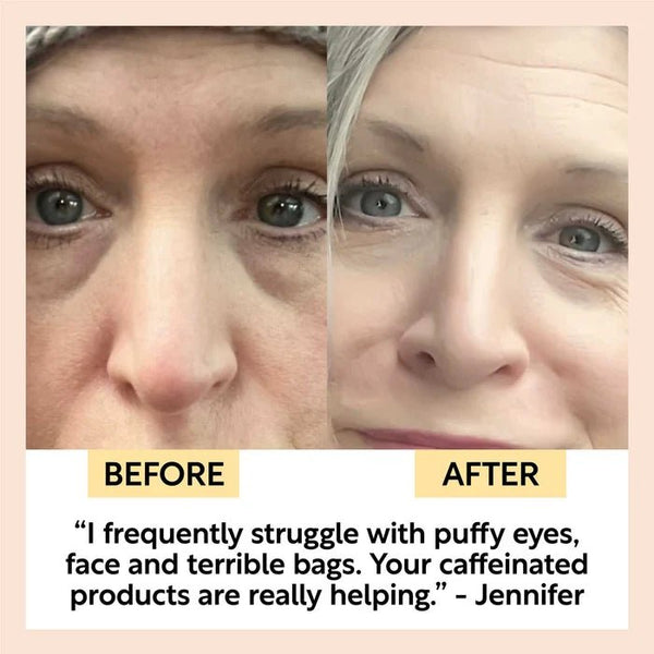 UpCircle Eye Cream with Hyaluronic Acid + Coffee - Plastic Freedom