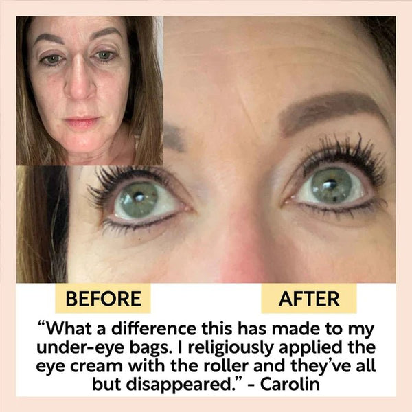 UpCircle Eye Cream with Hyaluronic Acid + Coffee - Plastic Freedom