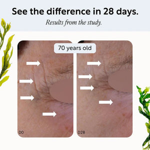 UpCircle Overnight Eye Treatment with Retinol Exosomes - Plastic Freedom