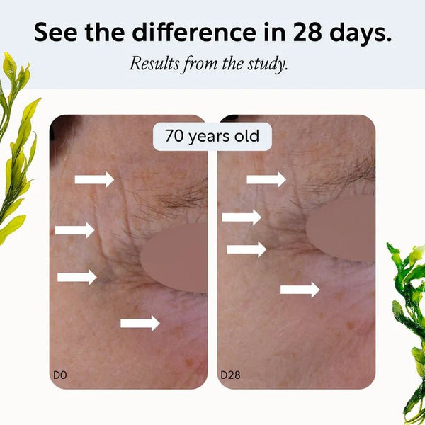 UpCircle Overnight Eye Treatment with Retinol Exosomes - Plastic Freedom