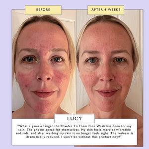 UpCircle Powder to Foam Face Wash - for Dull, Combination + Oily Skin - Plastic Freedom