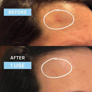 Evolve Beauty Blue Velvet Ceramide Serum - Plastic Freedom