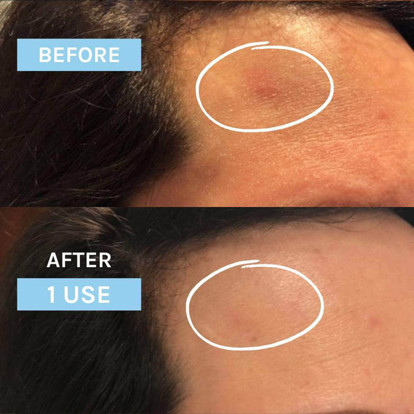 Evolve Beauty Blue Velvet Ceramide Serum - Plastic Freedom